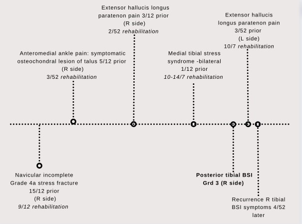 Tibial Bone Stress