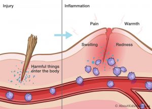 what-to-eat-when-youre-injured