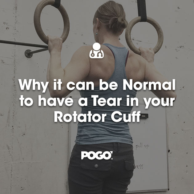 Rotator Cuff